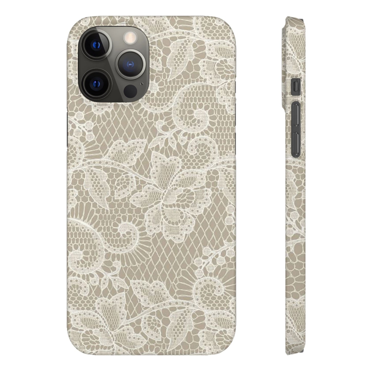 White Lace Phone Case